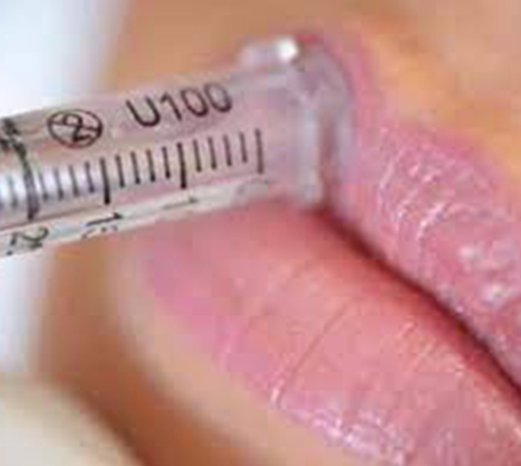 No needle lip filler